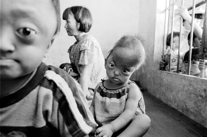 Децата във Виетнам продължават да се раждат и днес с увреждания заради Монсанто.